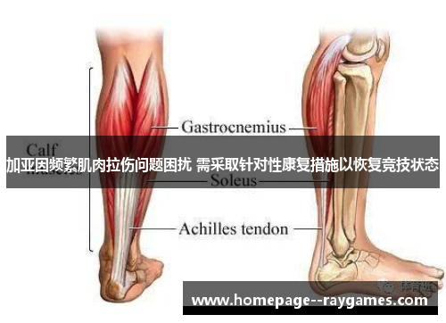 加亚因频繁肌肉拉伤问题困扰 需采取针对性康复措施以恢复竞技状态